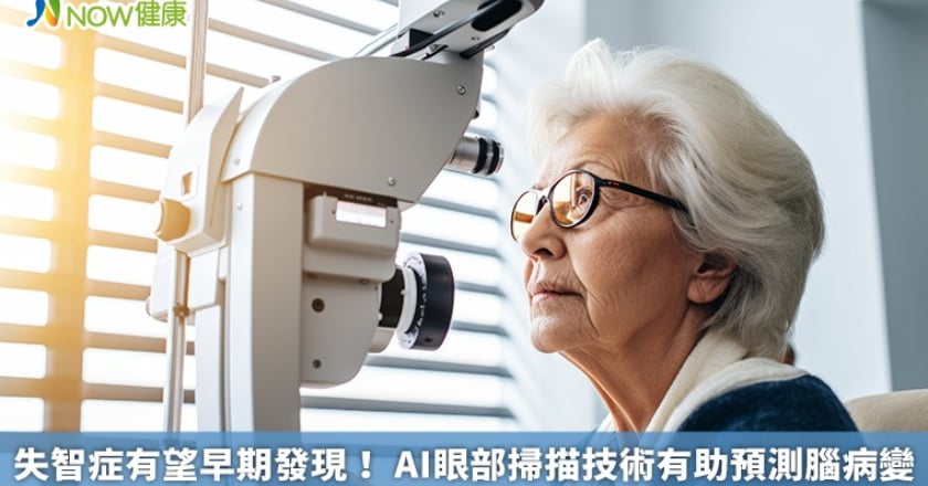失智症有望早期發現！ AI眼部掃描技術有助預測腦病變