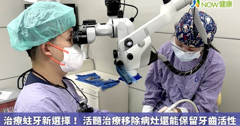治療蛀牙新選擇！ 活髓治療移除病灶還能保留牙齒活性
