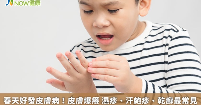 春天好發皮膚病!皮膚爆癢 濕疹、汗皰疹、乾癬最常見