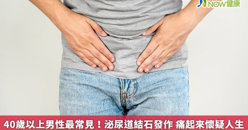 40歲以上男性最常見！泌尿道結石發作 痛起來懷疑人生