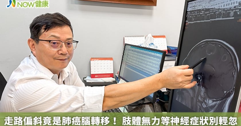 走路偏斜竟是肺癌腦轉移！ 肢體無力等神經症狀別輕忽