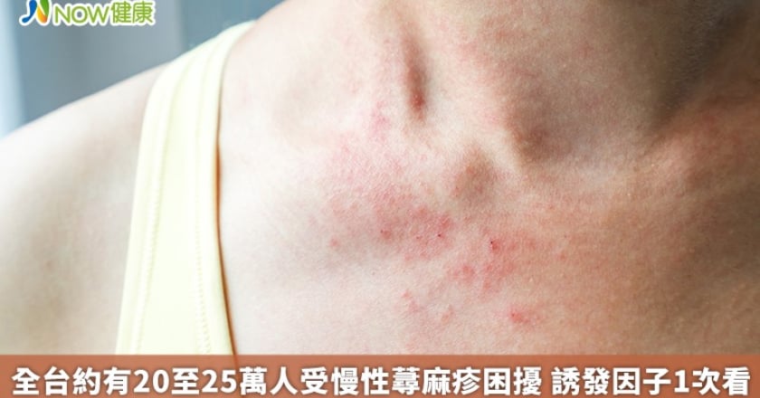 全台約有20至25萬人受慢性蕁麻疹困擾 誘發因子1次看