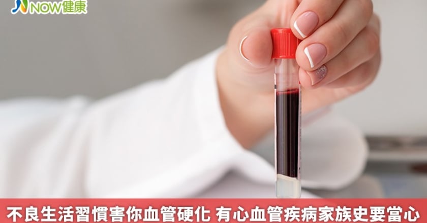 不良生活習慣害你血管硬化 有心血管疾病家族史要當心
