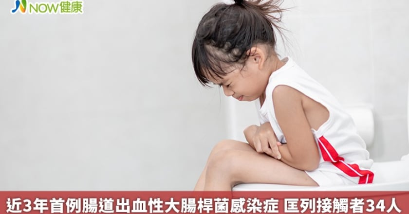 近3年首例腸道出血性大腸桿菌感染症 匡列接觸者34人