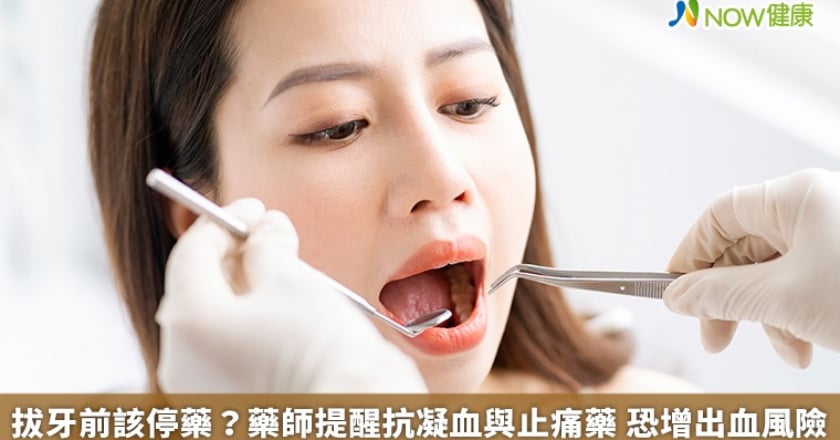 拔牙前該停藥？藥師提醒抗凝血與止痛藥 恐增出血風險