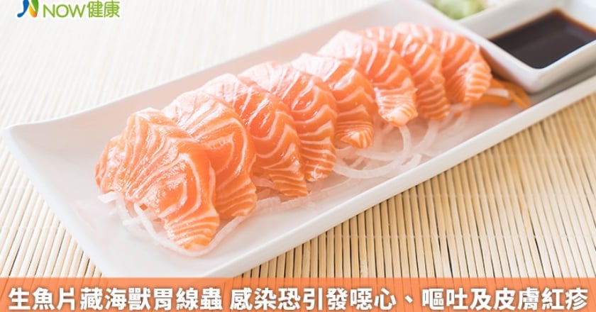 生魚片藏海獸胃線蟲 感染恐引發噁心、嘔吐及皮膚紅疹