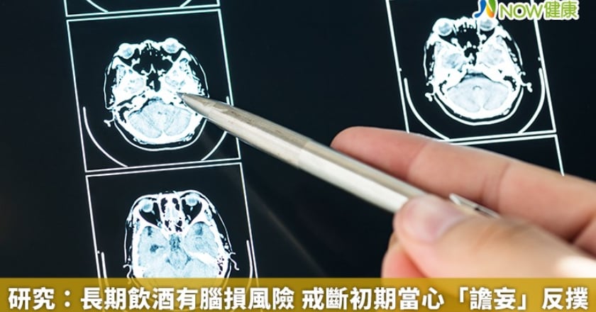 研究:長期飲酒有腦損風險 戒斷初期當心「譫妄」反撲