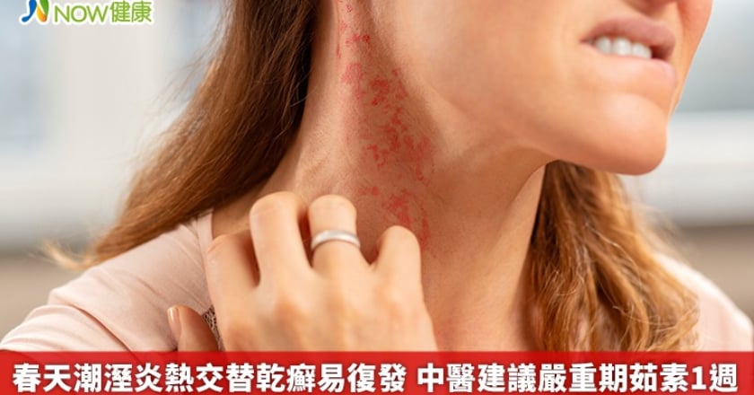 春天潮溼炎熱交替乾癬易復發 中醫建議嚴重期茹素1週