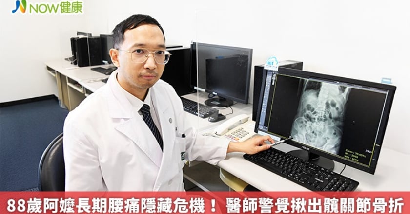 88歲阿嬤長期腰痛隱藏危機! 醫師警覺揪出髖關節骨折