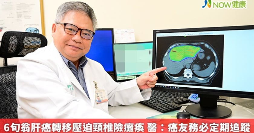 6旬翁肝癌轉移壓迫頸椎險癱瘓 醫:癌友務必定期追蹤