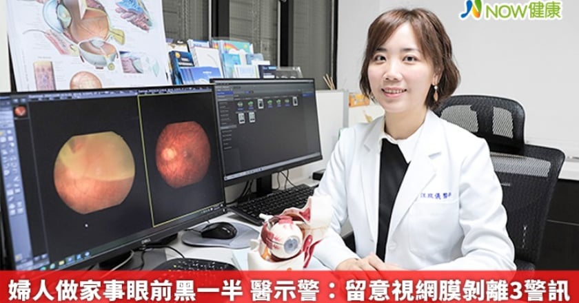 婦人做家事眼前黑一半 醫示警：留意視網膜剝離3警訊