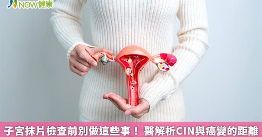 子宮抹片檢查前別做這些事! 醫解析CIN與癌變的距離