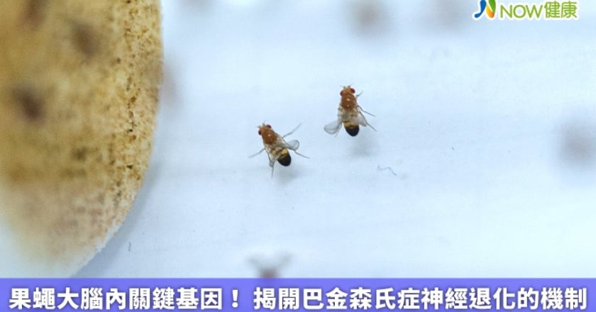 果蠅大腦內關鍵基因！ 揭開巴金森氏症神經退化的機制