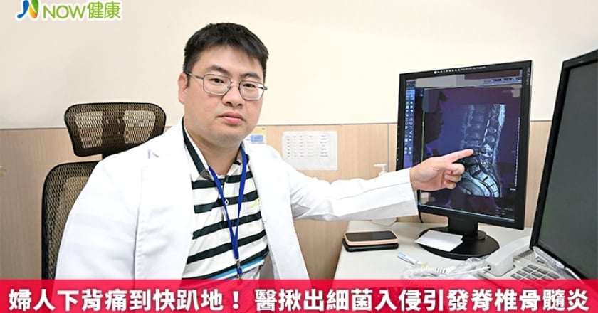 婦人下背痛到快趴地！ 醫揪出細菌入侵引發脊椎骨髓炎