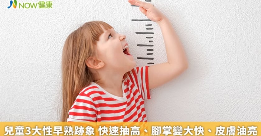 兒童3大性早熟跡象 快速抽高、腳掌變大快、皮膚油亮
