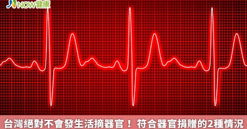 台灣絕對不會發生活摘器官！ 符合器官捐贈的2種情況