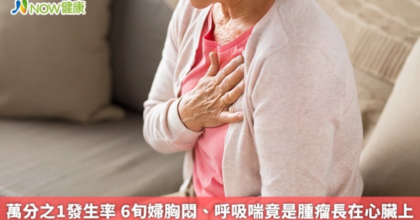 萬分之1發生率 6旬婦胸悶、呼吸喘竟是腫瘤長在心臟上