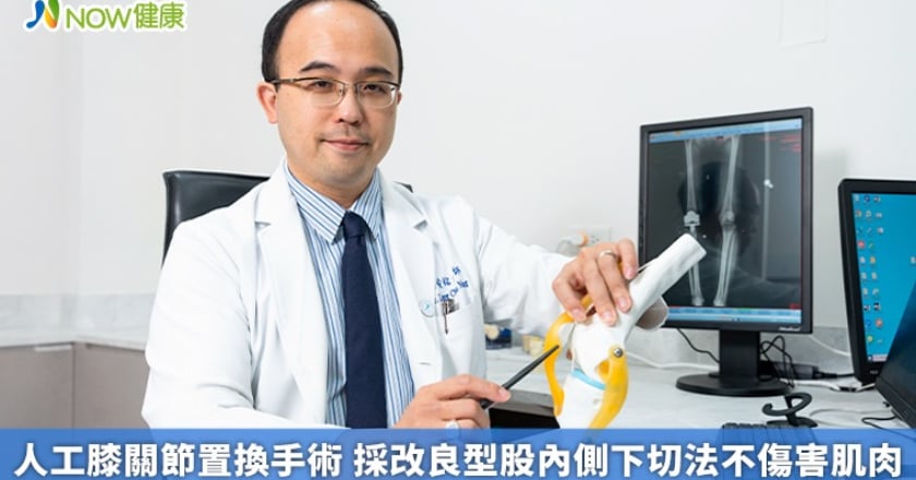 人工膝關節置換手術 採改良型股內側下切法不傷害肌肉