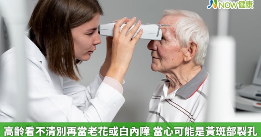 高齡看不清別再當老花或白內障 當心可能是黃斑部裂孔