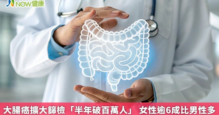 大腸癌擴大篩檢「半年破百萬人」 女性逾6成比男性多