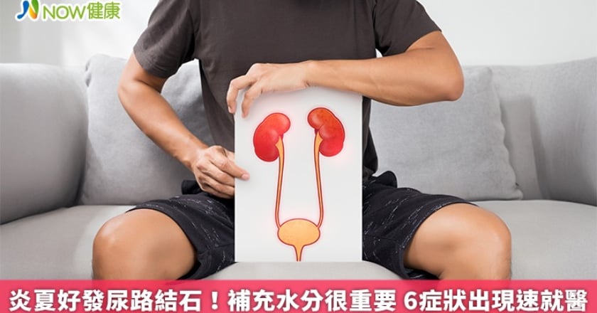 炎夏好發尿路結石！補充水分很重要 6症狀出現速就醫