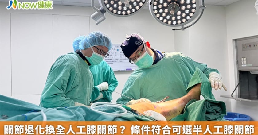 關節退化換全人工膝關節？ 條件符合可選半人工膝關節