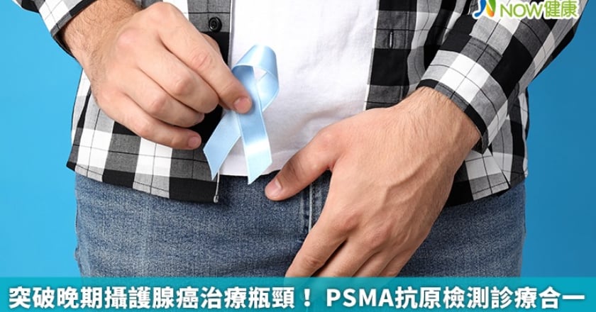 突破晚期攝護腺癌治療瓶頸！ PSMA抗原檢測診療合一