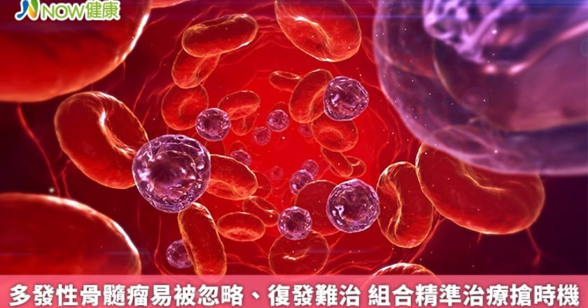 多發性骨髓瘤易被忽略、復發難治 組合精準治療搶時機