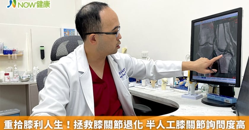 重拾膝利人生！拯救膝關節退化 半人工膝關節詢問度高