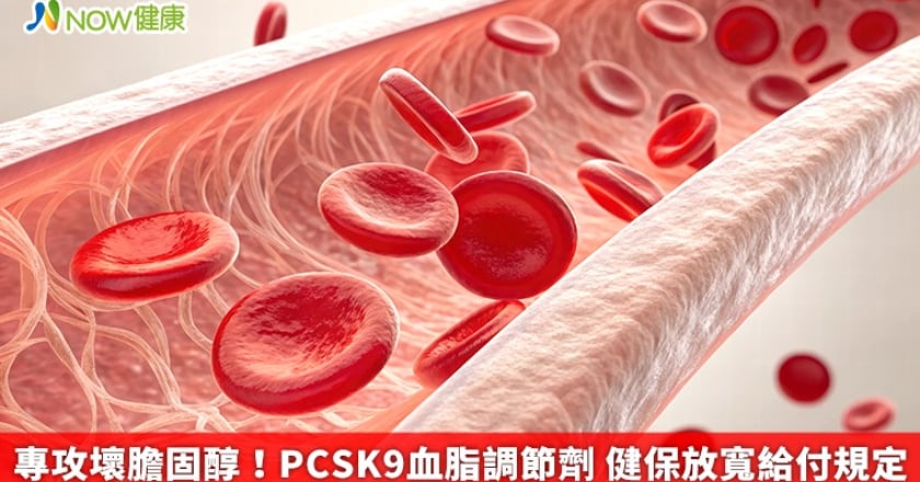 專攻壞膽固醇！PCSK9血脂調節劑 健保放寬給付規定