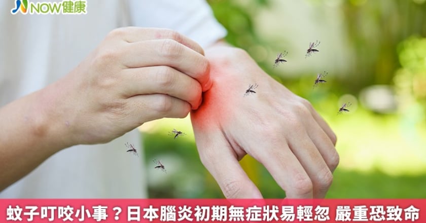 蚊子叮咬小事?日本腦炎初期無症狀易輕忽 嚴重恐致命
