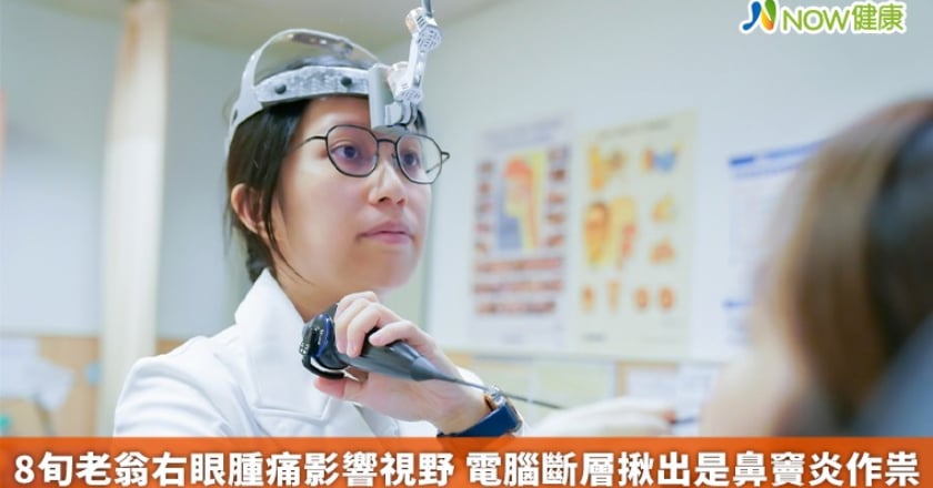 8旬老翁右眼腫痛影響視野 電腦斷層揪出是鼻竇炎作祟