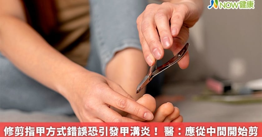 修剪指甲方式錯誤恐引發甲溝炎！ 醫：應從中間開始剪