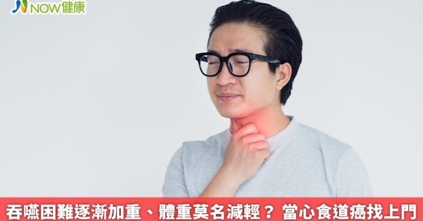 吞嚥困難逐漸加重、體重莫名減輕? 當心食道癌找上門