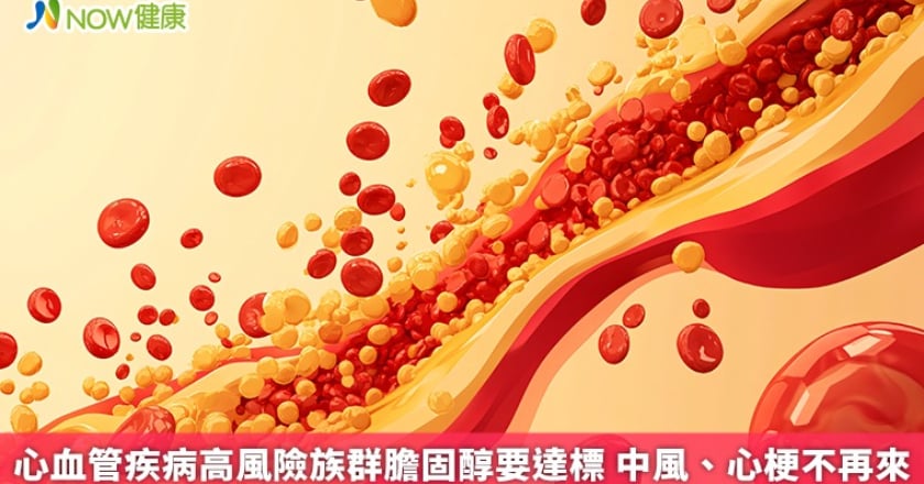 心血管疾病高風險族群膽固醇要達標 中風、心梗不再來