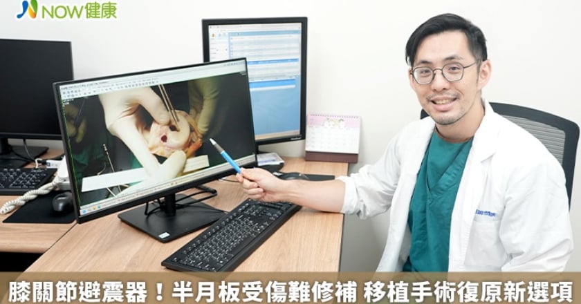 膝關節避震器！半月板受傷難修補 移植手術復原新選項