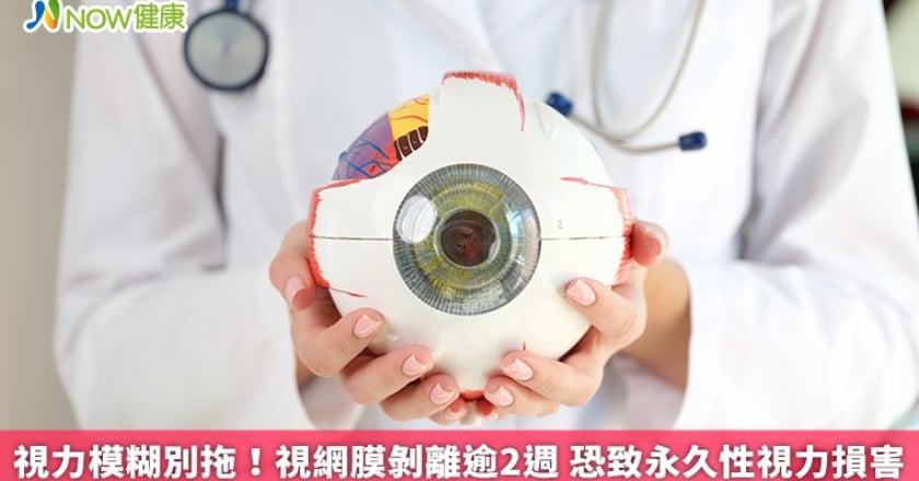 視力模糊別拖！視網膜剝離逾2週 恐致永久性視力損害