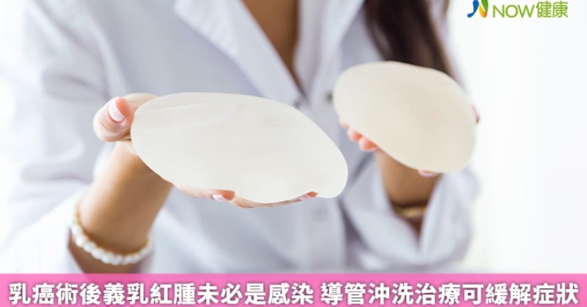 乳癌術後義乳紅腫未必是感染 導管沖洗治療可緩解症狀