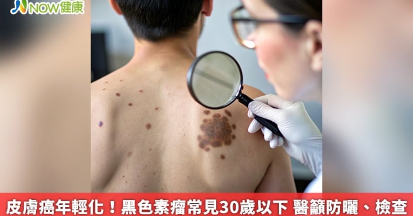 皮膚癌年輕化!黑色素瘤常見30歲以下 醫籲防曬、檢查