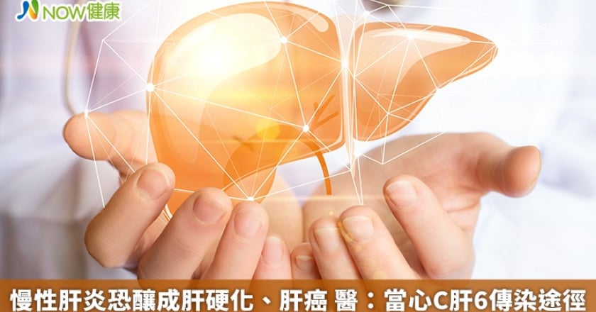 慢性肝炎恐釀成肝硬化、肝癌 醫:當心C肝6傳染途徑