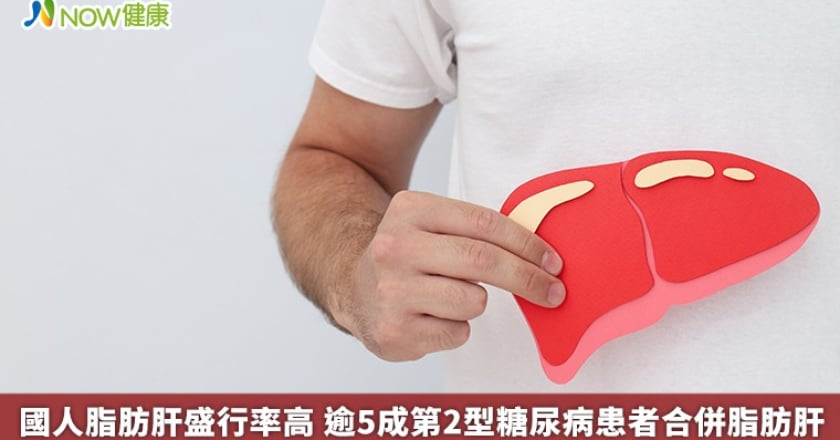 國人脂肪肝盛行率高 逾5成第2型糖尿病患者合併脂肪肝