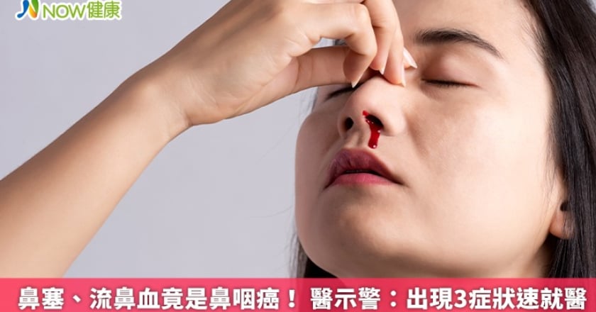 鼻塞、流鼻血竟是鼻咽癌! 醫示警:出現3症狀速就醫