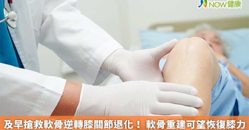及早搶救軟骨逆轉膝關節退化! 軟骨重建可望恢復膝力