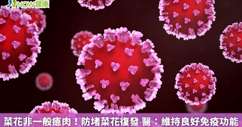 菜花非一般瘜肉!防堵菜花復發 醫:維持良好免疫功能