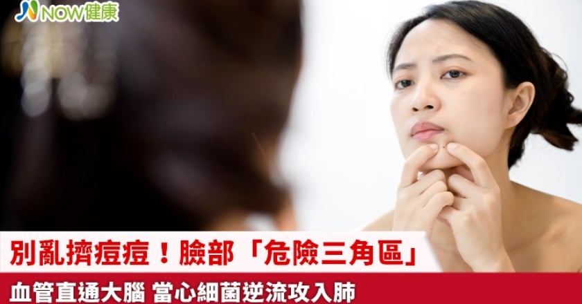 別亂擠痘痘!臉部「危險三角區」血管直通大腦 當心細菌逆流攻入肺