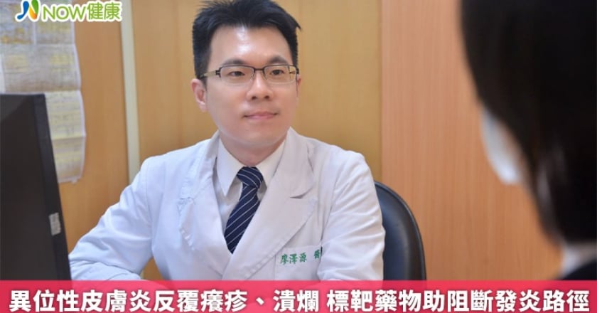 異位性皮膚炎反覆癢疹、潰爛 標靶藥物助阻斷發炎路徑