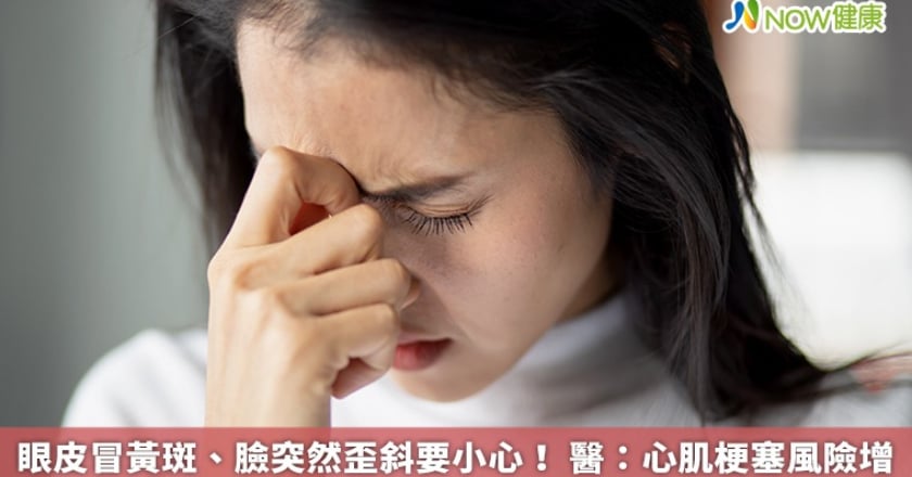 眼皮冒黃斑、臉突然歪斜要小心！ 醫：心肌梗塞風險增
