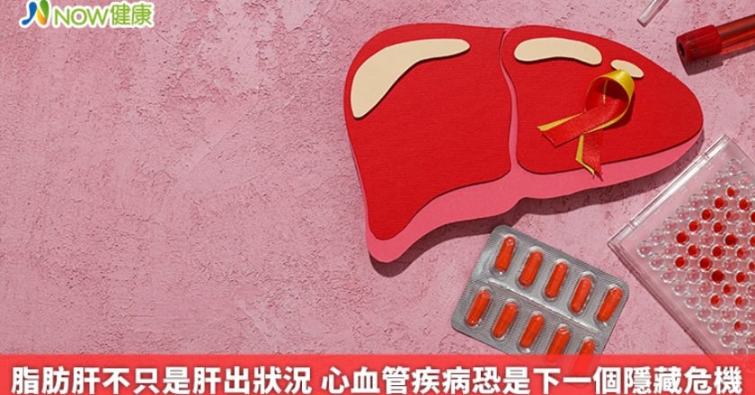 脂肪肝不只是肝出狀況 心血管疾病恐是下一個隱藏危機