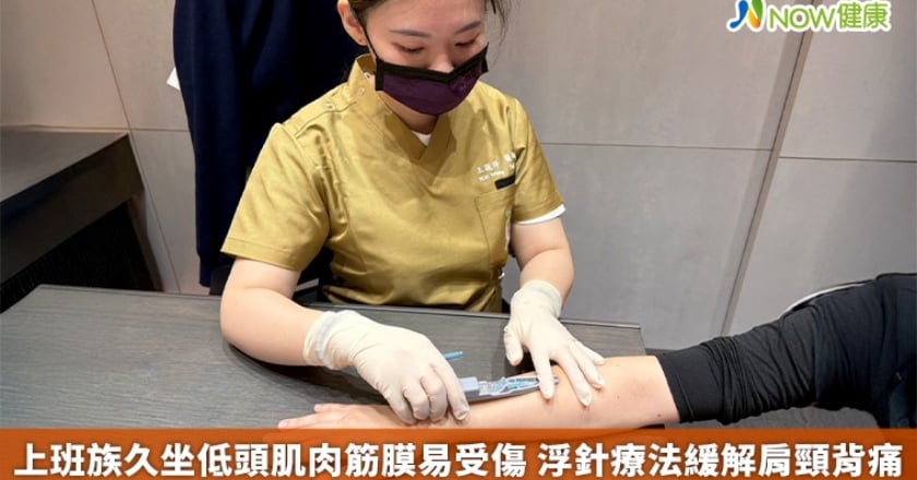 上班族久坐低頭肌肉筋膜易受傷 浮針療法緩解肩頸背痛
