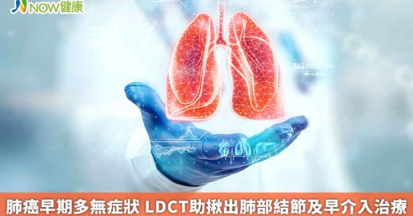 肺癌早期多無症狀 LDCT助揪出肺部結節及早介入治療